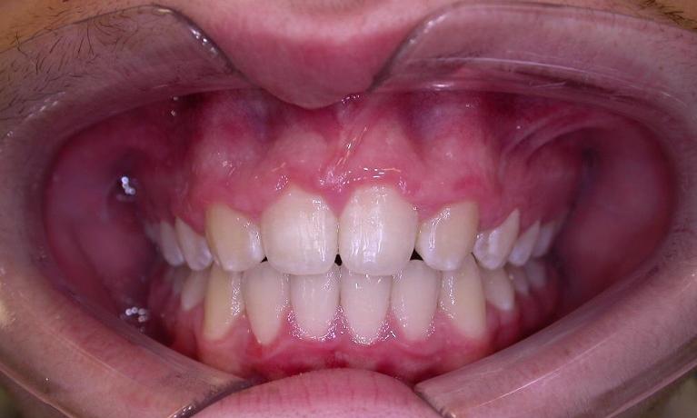 Orthodontics-After-Image